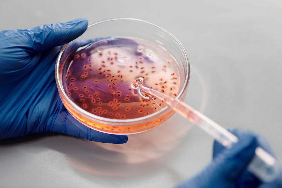 How Are Genetic Conditions Passed Through Families?